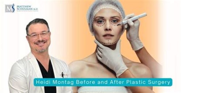 Heidi Montag Plastic Surgery: Before And After Transformation