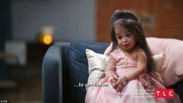 Jyoti Amge Afflicted By The Rarest Disease