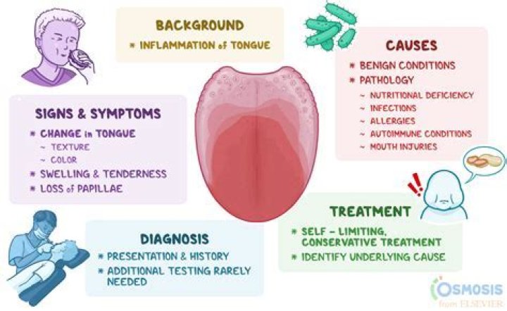 Latest Developments In Drummond Diagnosis