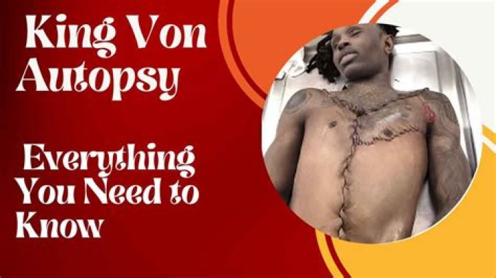 Revealing King Von's Autopsy: Disturbing Details Emerge