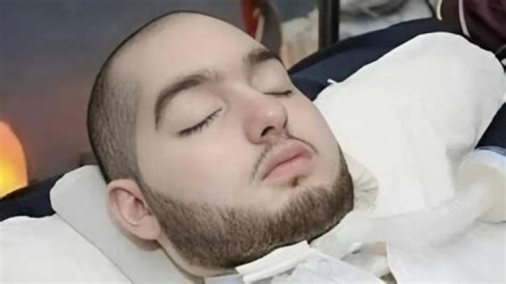 The Enigma Of The "Sleeping Prince": Unraveling The Mystery Of The Coma