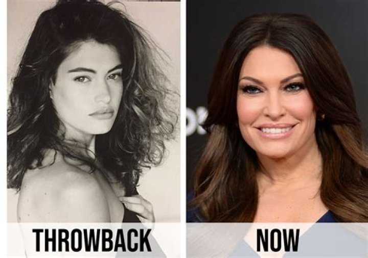 Transformative Journey: Kimberly Guilfoyle Before And After Images
